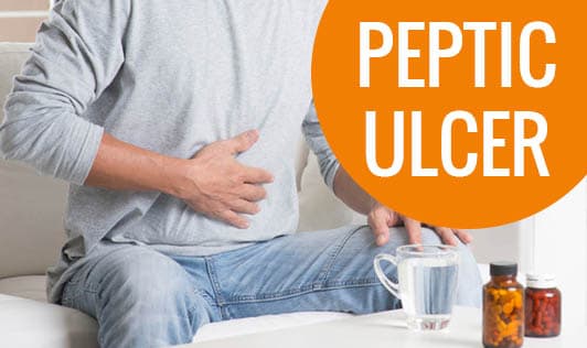 Peptic Ulcer