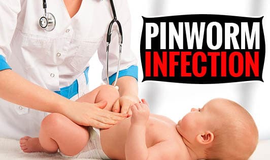 Pinworm Infection