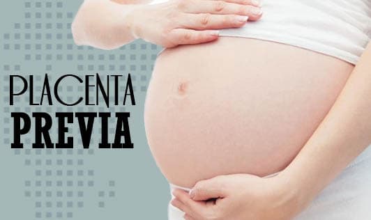 Placenta Previa