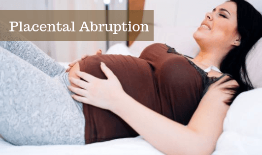 Placental abruption