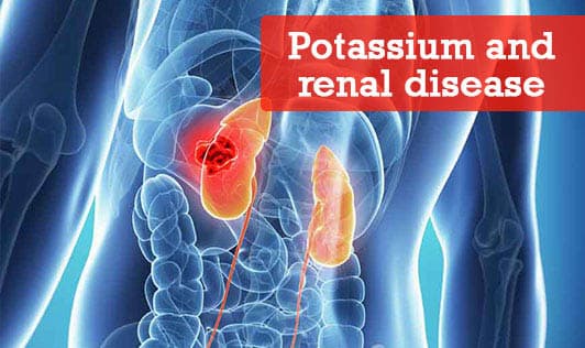 Potassium and renal disease 