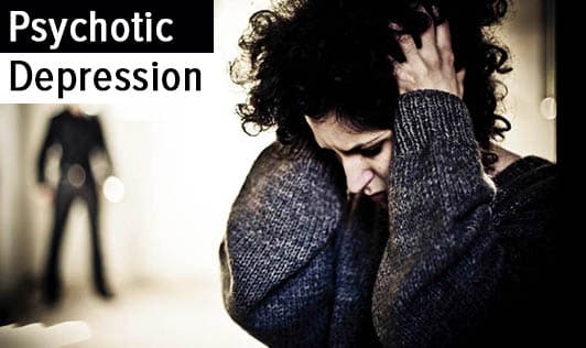 Psychotic Depression