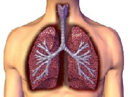 Pulmonary Edema 