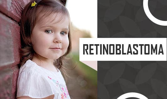 Retinoblastoma