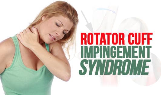 Rotator Cuff Impingement Syndrome