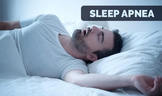 SLEEP APNEA- Signs, Treatment & More