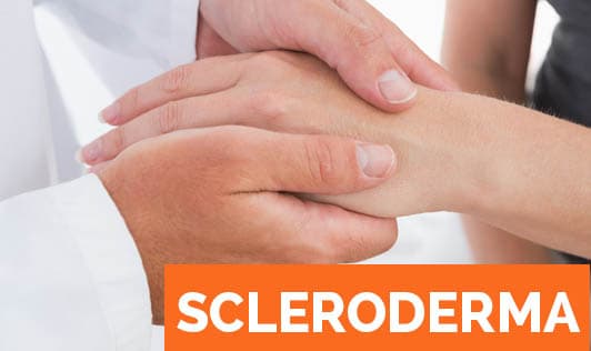 Scleroderma