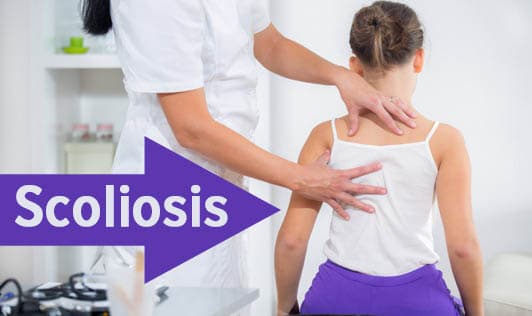 Scoliosis