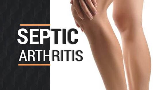 Septic arthritis