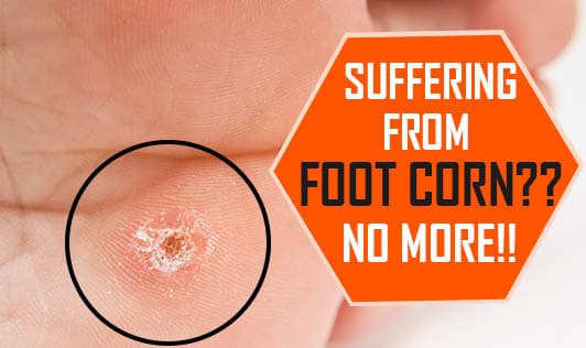 Suffering from Foot Corn? No more!!
