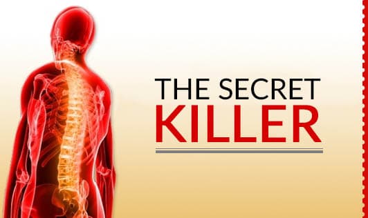 The Secret Killer
