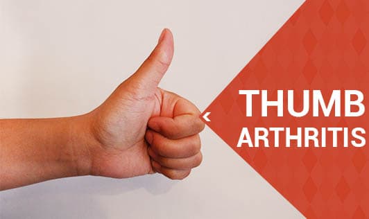 Thumb arthritis