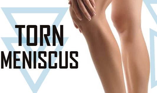Torn Meniscus