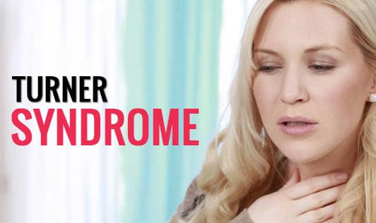 Turner Syndrome