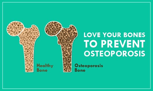 WORLD OSTEOPOROSIS DAY 2018