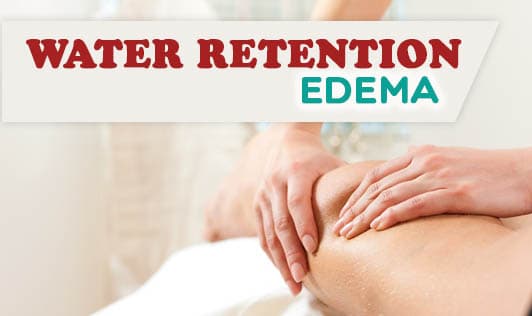 Water Retention - edema