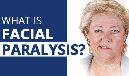 What is Facial paralysis?