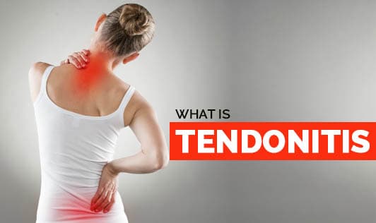 What is Tendonitis?