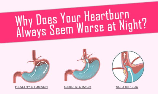 Why does your heatburn always seem worse at night?