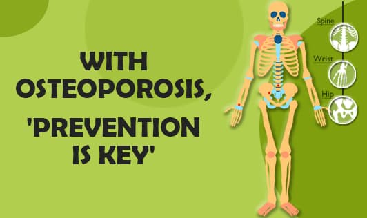 With osteoporosis, 'prevention is the key'