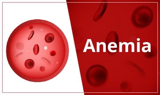 Everything you should know about Anemia