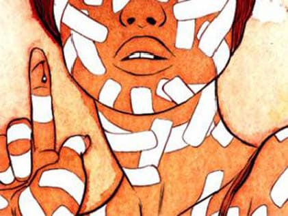 Dermatillomania (Skin-picking)