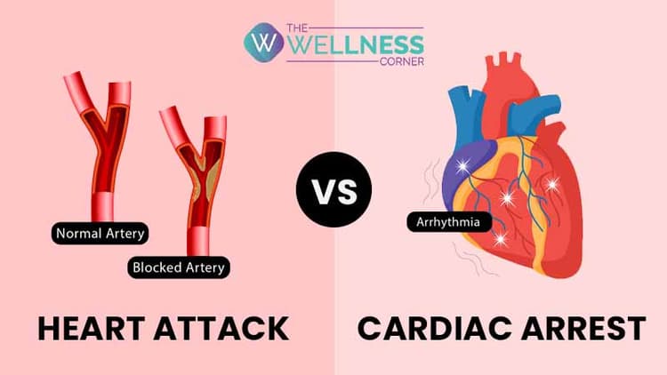 Heart Attack v/s Cardiac Arrest