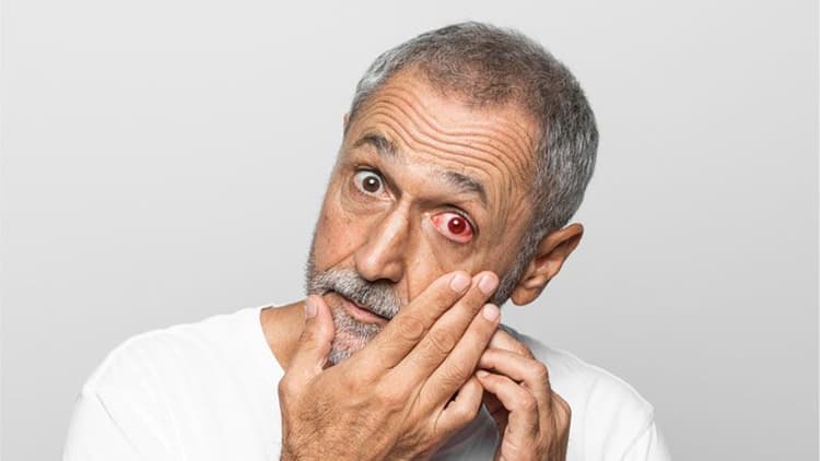 Glaucoma