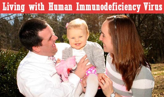 Living with Human Immunodeficiency Virus