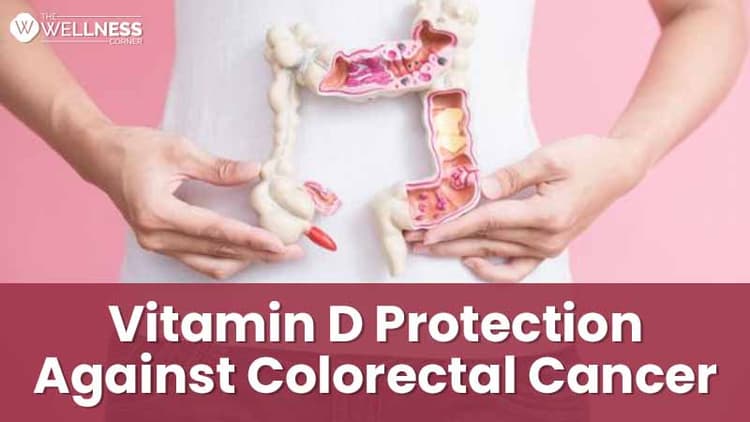 Low intake of vitamin D may promote colorectal cancer