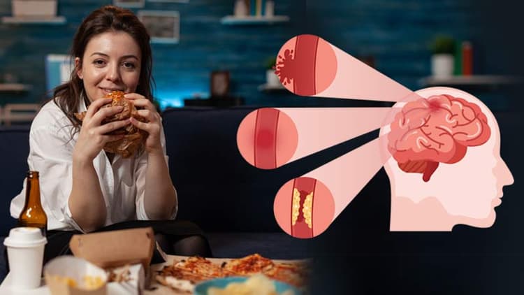 Lifestyle Choices That May Lead To Stroke