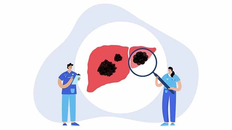 Signs Of Liver Toxicity You Should Be Aware Of