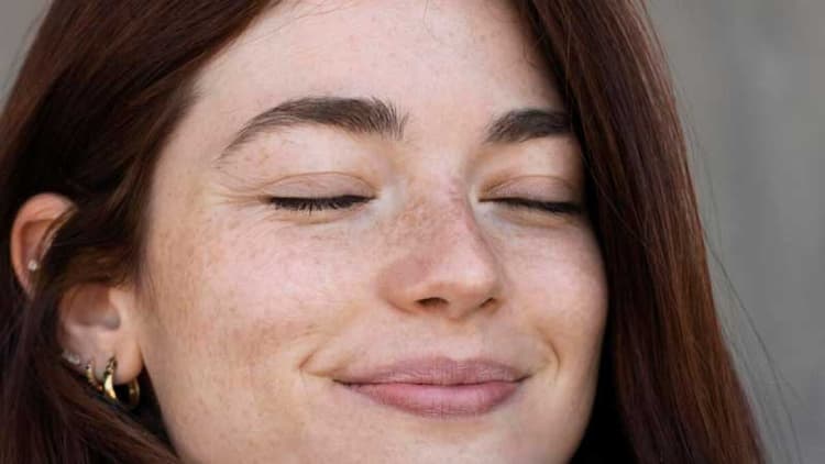 Do Not Mistake Pigmentation For Freckles!