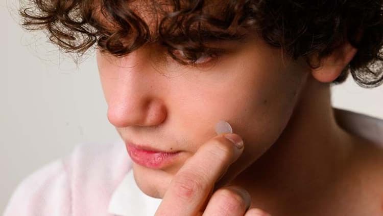 Do Pimple Patches Really Work?
