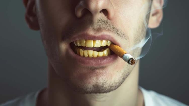Effects Of Tobacco On Oral Health