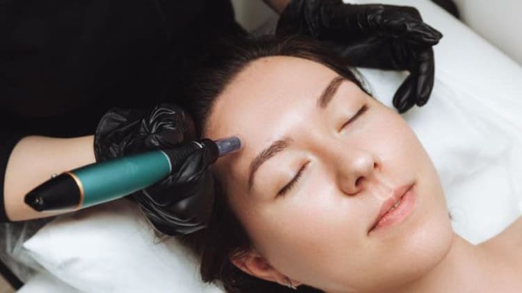 Everyone’s Talking About PRP Microneedling… But Does It Actually Do Anything?
